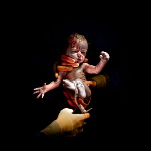 newborn-baby-christian-berthelot-c-section-cesar